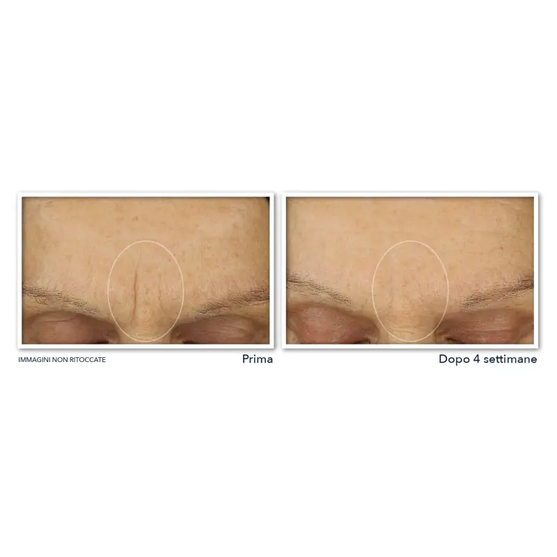 Retinol Correxion Line Smoothing Crema Viso Massima Idratazione - Trattamento antietà pelli mature, Crema antirughe miniatura 4