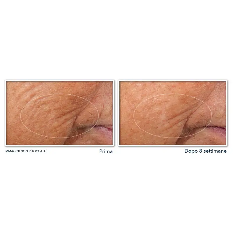 Retinol Correxion Line Smoothing Siero Viso Notte in Capsule - Trattamento antietà pelli mature, Crema antirughe, Siero antirughe miniatura 4