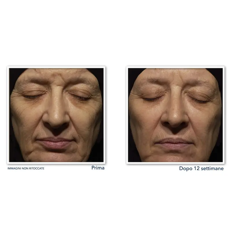 Retinol Correxion Wrinkle Correct Crema Viso Notte - Trattamento antietà pelli mature, Crema antirughe miniatura 4