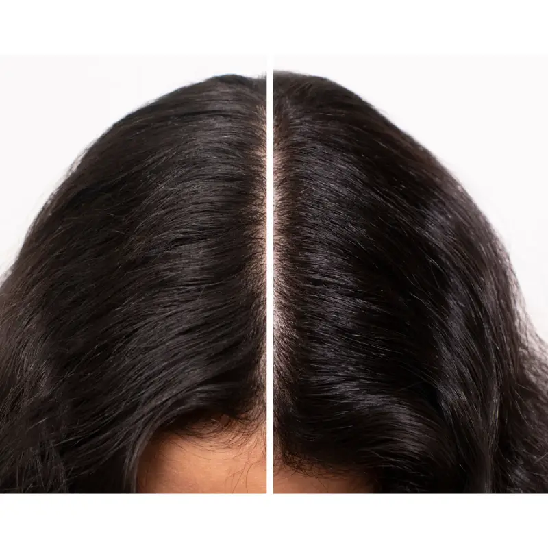 Essence Absolue Nourishing Soothing Scalp Oil Concentrate - Olio capelli miniatura 3