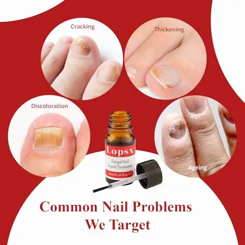 Trattamento per Micosi Unghie Piede Lopsx – Antimicotico Unghie Piedi Formula Innovativa e Delicata, Protezione miniatura 3