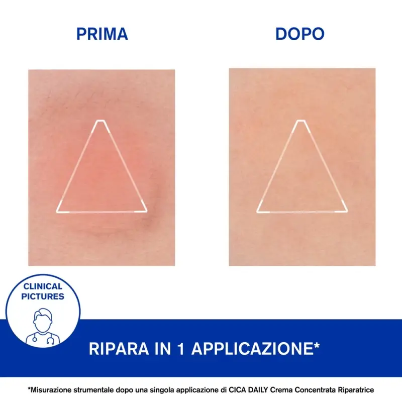 CICA DAILY Gel-Crema Riparatore - Crema idratante viso miniatura 4