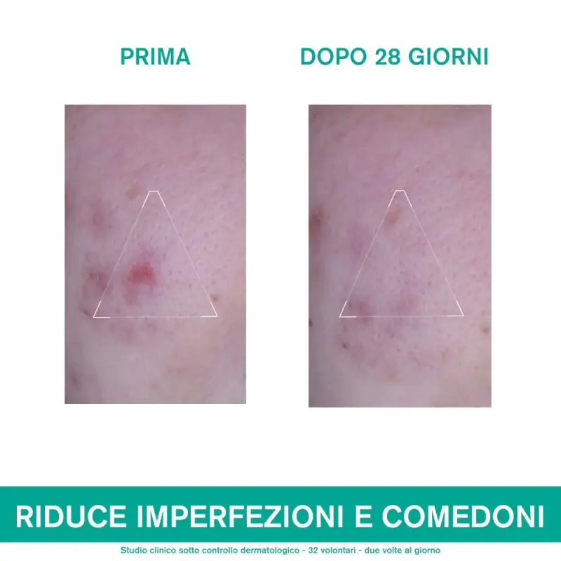 HYSÉAC 3 Regul+ Trattamento Globale Anti-Imperfezioni - Crema viso pelle grassa miniatura 4