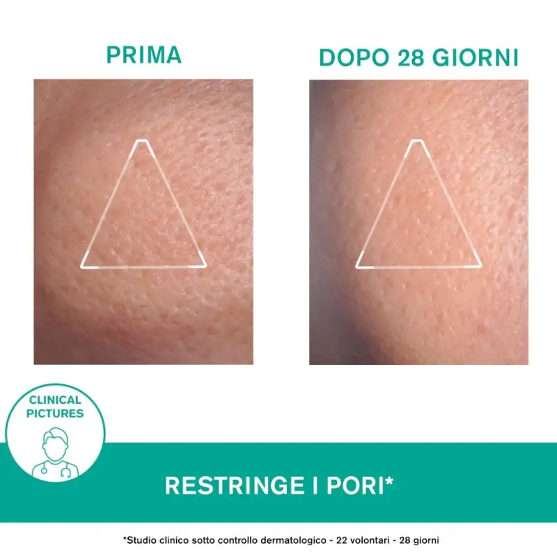 HYSÉAC Mat Trattamento Opacizzante - Crema viso pelle grassa miniatura 4