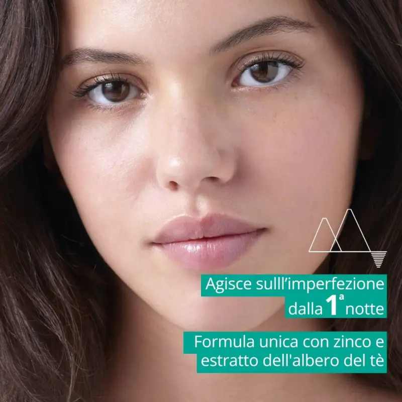 HYSÉAC Pasta SOS - Crema viso pelle grassa miniatura 5