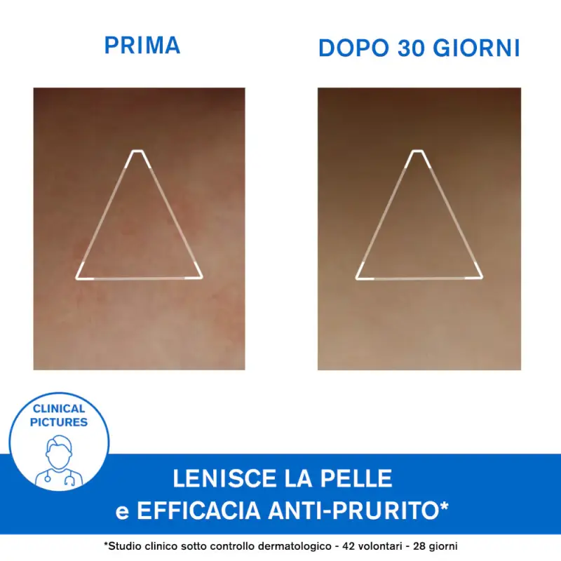 XÉMOSE Cerato liporestitutivo anti-irritazioni - Crema corpo miniatura 4