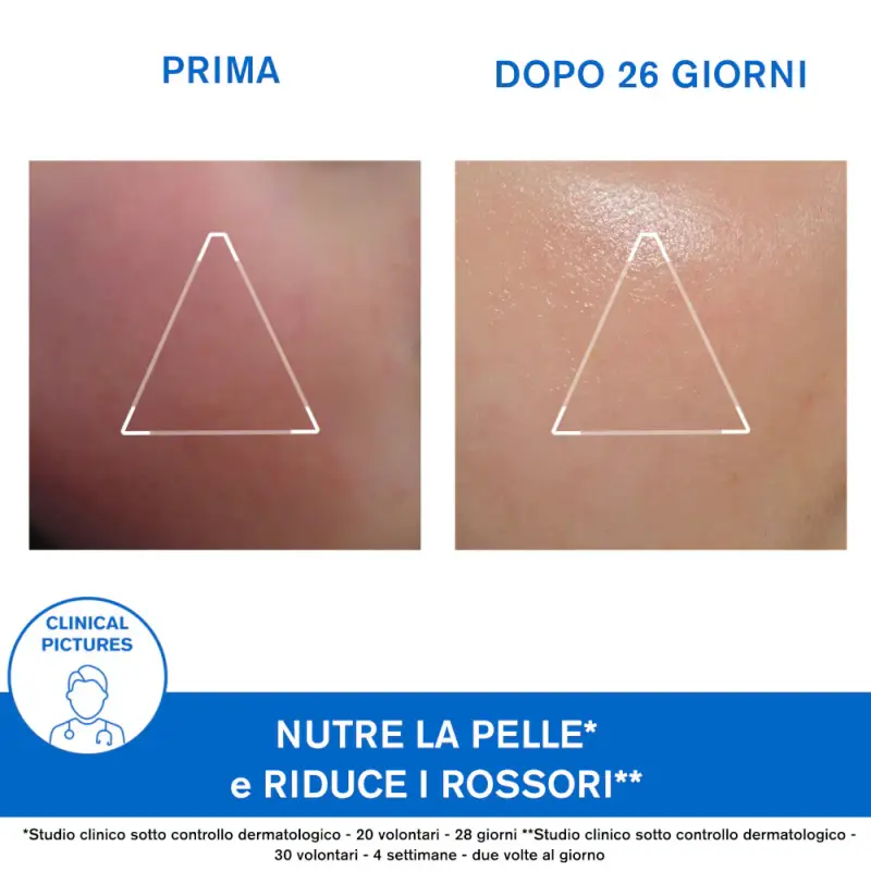 XÉMOSE Crema Viso - Crema viso pelle secca, Crema idratante viso miniatura 4