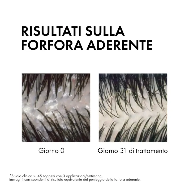 Dercos DT Shampoo Antiforfora DS capelli da normali a grassi - Shampoo antiforfora, Forfora miniatura 3