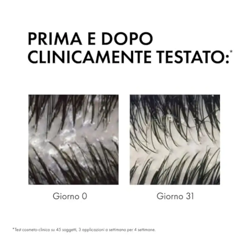 Vichy Dercos, Shampoo Anti-Forfora DS Eco-Ricarica, Per Capelli da Normali a Grassi, Azione Riequilibrante, Effetto miniatura 3