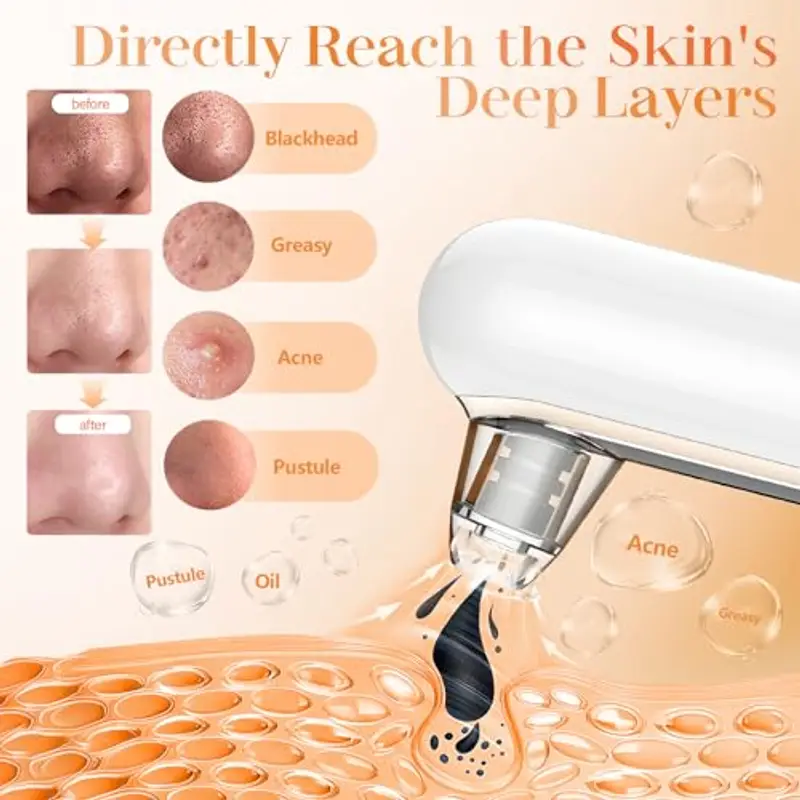 Yccu Aspiratore Punti Neri Professionale, Elettrico Comedone per Pulizia Viso e Rimozione Pori, Aspira Brufoli e Impurità con 4 Testine e 4 Modalità di Aspirazione, Blackhead Remover Vacuum miniatura 3